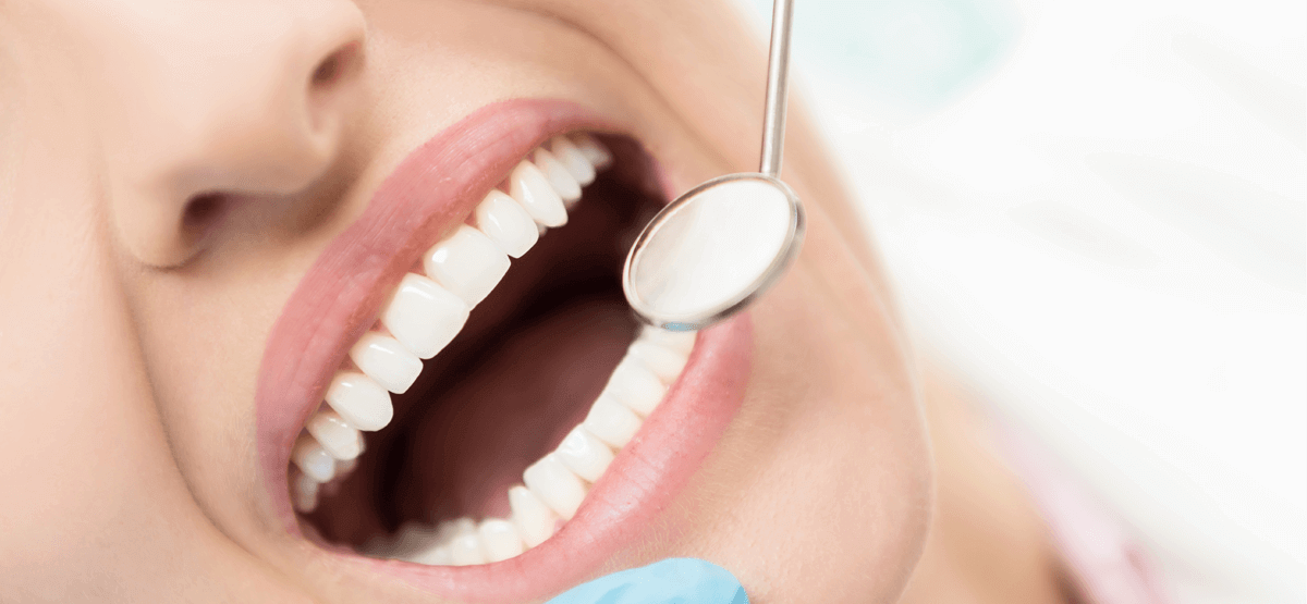 Próchnica zębów: Przyczyny, objawy i leczenie